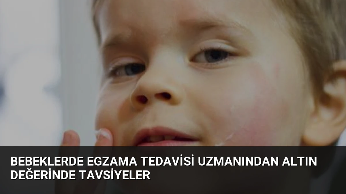 Bebeklerde Egzama Tedavisi Uzmanından Altın Değerinde Tavsiyeler