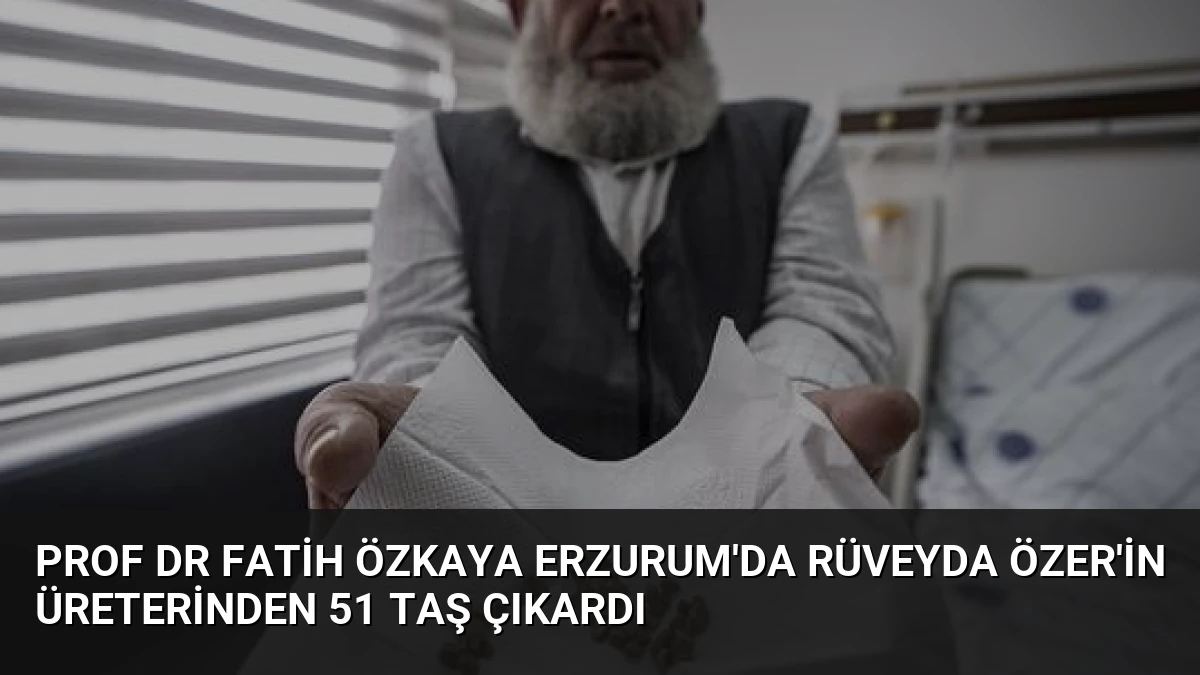 Prof Dr Fatih Özkaya Erzurum’da Rüveyda Özer’in üreterinden 51 taş çıkardı