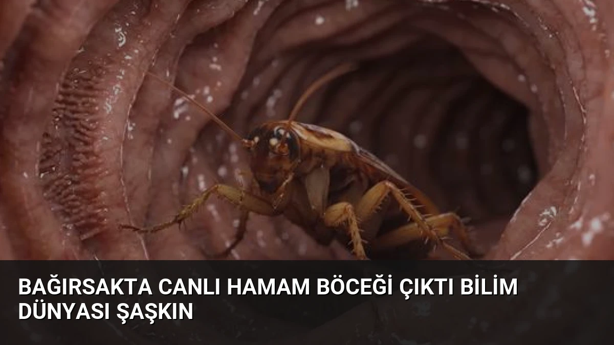 Bağırsakta Canlı Hamam Böceği Çıktı Bilim Dünyası Şaşkın