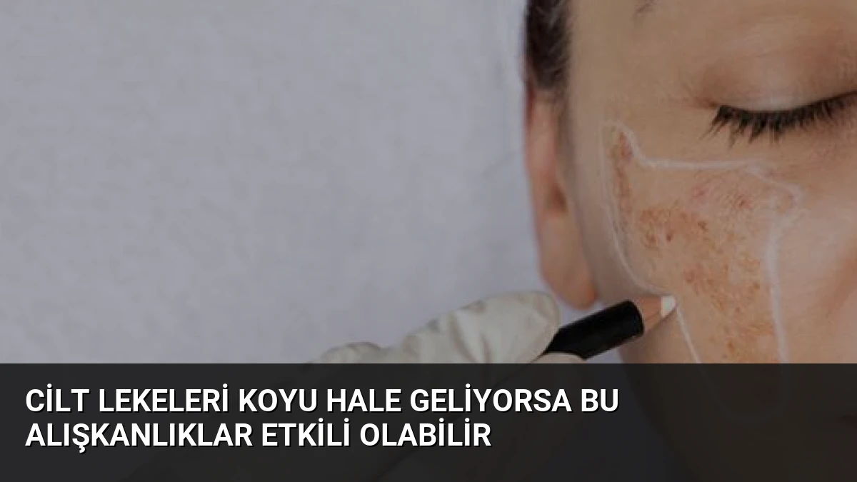 Cilt Lekeleri Koyu Hale Geliyorsa Bu Alışkanlıklar Etkili Olabilir