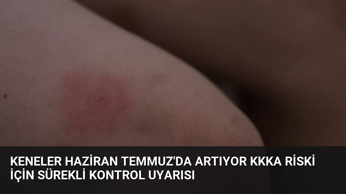 Keneler Haziran Temmuz’da Artıyor KKKA Riski İçin Sürekli Kontrol Uyarısı