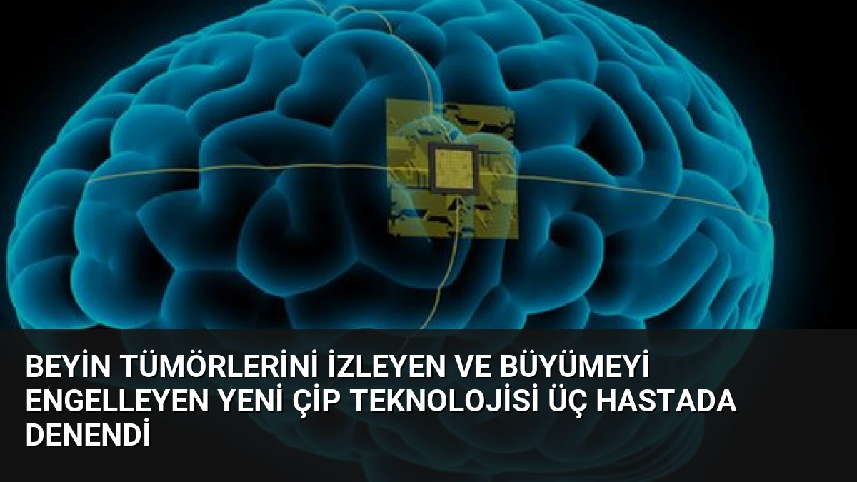 Beyin Tümörlerini İzleyen ve Büyümeyi Engelleyen Yeni Çip Teknolojisi Üç Hastada Denendi